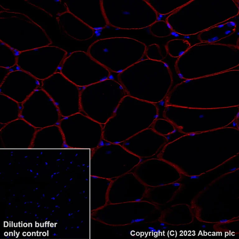 Immunohistochemistry (Formalin/PFA-fixed paraffin-embedded sections) - Alexa Fluor® 647 Anti-gamma Sarcoglycan antibody [EPR17862-7] (AB315257)