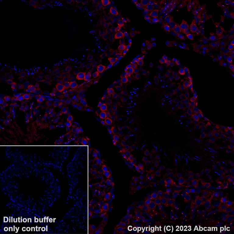 Immunohistochemistry (Formalin/PFA-fixed paraffin-embedded sections) - Alexa Fluor® 647 Anti-gamma Tubulin - Centrosome Marker antibody [EPR16793] (AB314509)
