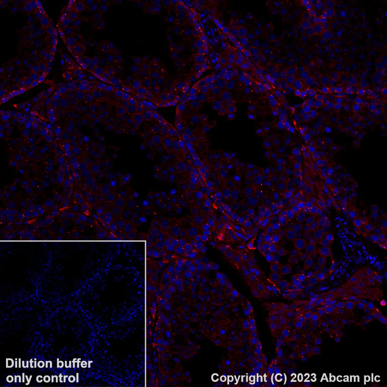 Immunohistochemistry (Formalin/PFA-fixed paraffin-embedded sections) - Alexa Fluor® 647 Anti-gamma Tubulin - Centrosome Marker antibody [EPR16793] (AB314509)