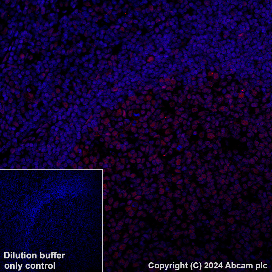 Immunohistochemistry (Formalin/PFA-fixed paraffin-embedded sections) - Alexa Fluor® 647 Anti-GATAD2B antibody [EPR27329-3] (AB317760), expandable thumbnail