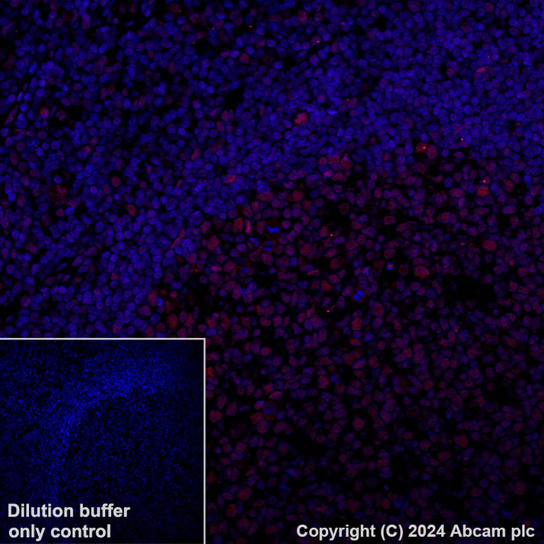 Immunohistochemistry (Formalin/PFA-fixed paraffin-embedded sections) - Alexa Fluor® 647 Anti-GATAD2B antibody [EPR27329-3] (AB317760)