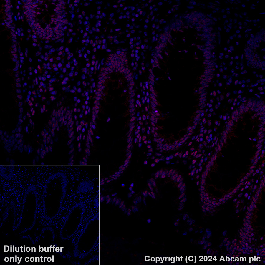 Immunohistochemistry (Formalin/PFA-fixed paraffin-embedded sections) - Alexa Fluor® 647 Anti-GATAD2B antibody [EPR27329-3] (AB317760), expandable thumbnail