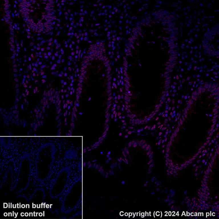 Immunohistochemistry (Formalin/PFA-fixed paraffin-embedded sections) - Alexa Fluor® 647 Anti-GATAD2B antibody [EPR27329-3] (AB317760)