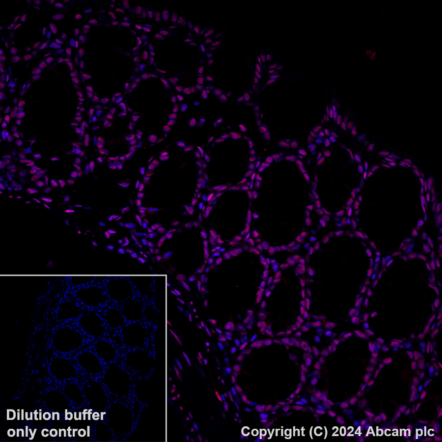 Immunohistochemistry (Formalin/PFA-fixed paraffin-embedded sections) - Alexa Fluor® 647 Anti-GATAD2B antibody [EPR27329-3] (AB317760), expandable thumbnail
