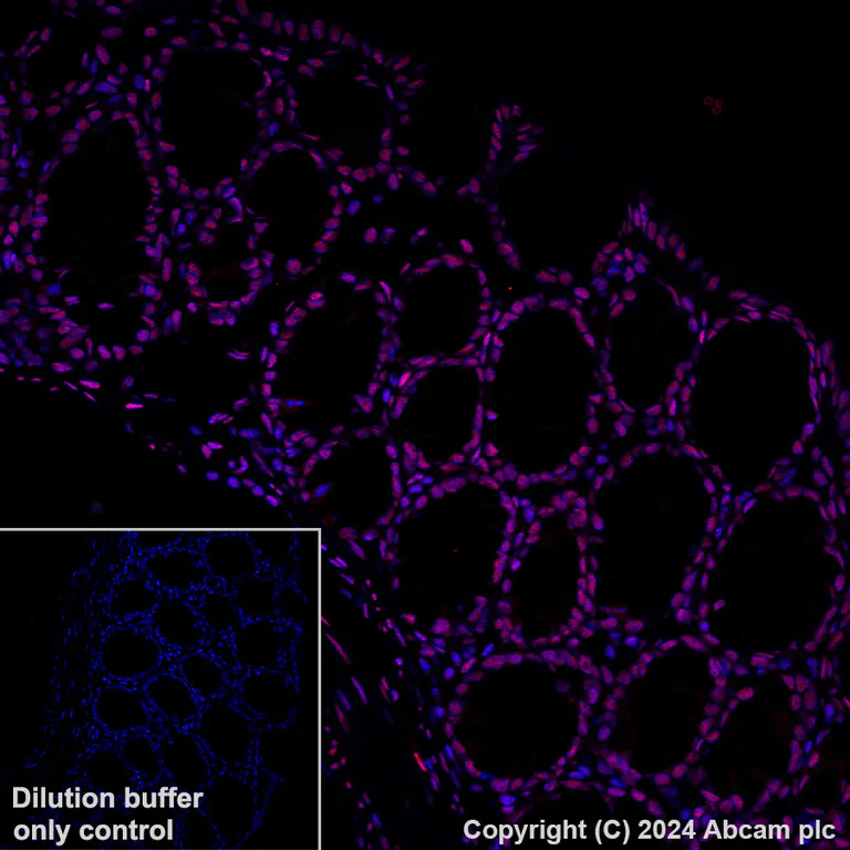 Immunohistochemistry (Formalin/PFA-fixed paraffin-embedded sections) - Alexa Fluor® 647 Anti-GATAD2B antibody [EPR27329-3] (AB317760)