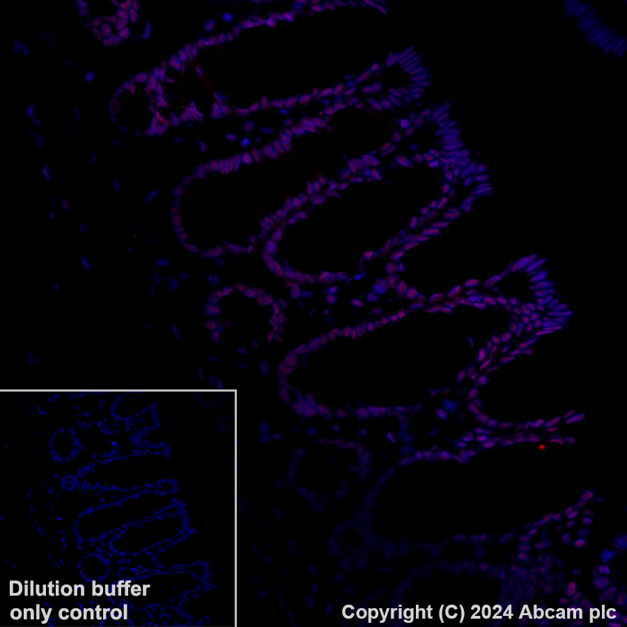 Immunohistochemistry (Formalin/PFA-fixed paraffin-embedded sections) - Alexa Fluor® 647 Anti-GATAD2B antibody [EPR27329-3] (AB317760), expandable thumbnail