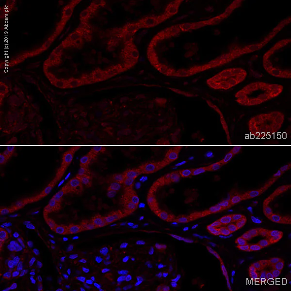Immunohistochemistry (Formalin/PFA-fixed paraffin-embedded sections) - Alexa Fluor® 647 Anti-GBA antibody [EPR5143(3)] (AB225150)