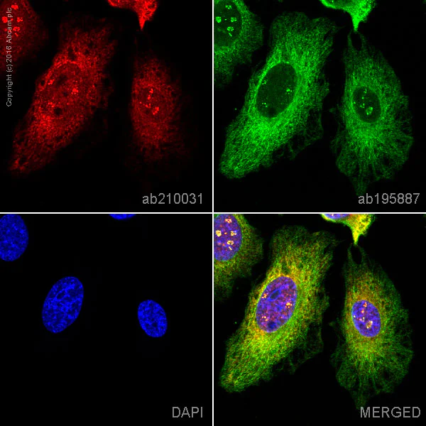 Immunocytochemistry/ Immunofluorescence - Alexa Fluor® 647 Anti-Gemin 3 antibody [EPR11283] (AB210031)