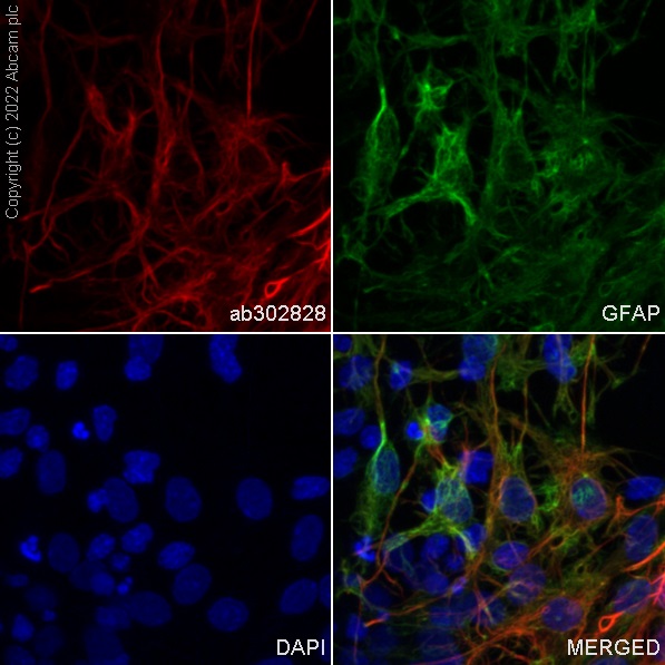 Immunocytochemistry/ Immunofluorescence - Alexa Fluor® 647 Anti-GFAP antibody [EP672Y] - Astrocyte Marker (AB302828), expandable thumbnail