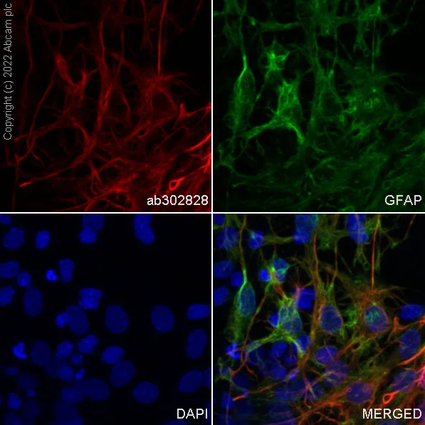 Immunocytochemistry/ Immunofluorescence - Alexa Fluor® 647 Anti-GFAP antibody [EP672Y] - Astrocyte Marker (AB302828)