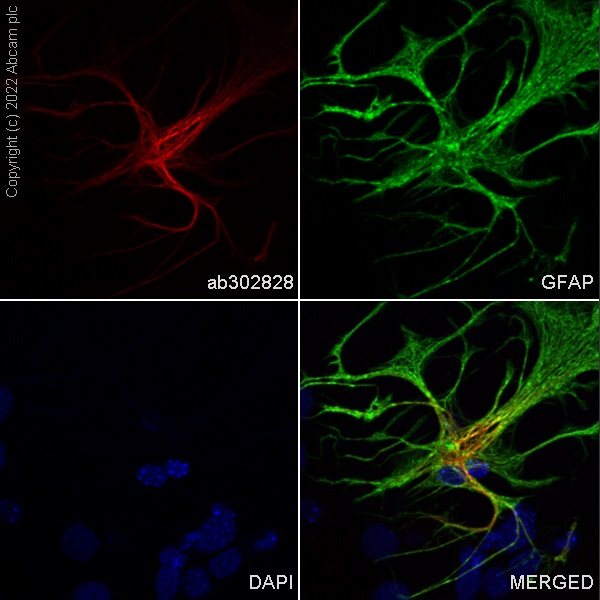 Immunocytochemistry/ Immunofluorescence - Alexa Fluor® 647 Anti-GFAP antibody [EP672Y] - Astrocyte Marker (AB302828), expandable thumbnail
