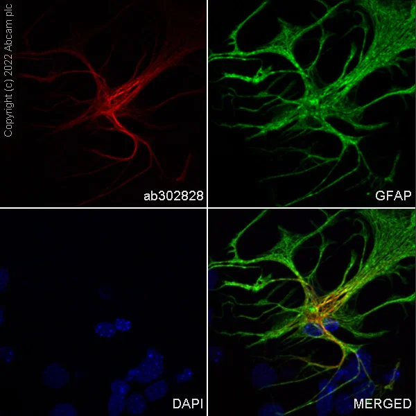 Immunocytochemistry/ Immunofluorescence - Alexa Fluor® 647 Anti-GFAP antibody [EP672Y] - Astrocyte Marker (AB302828)