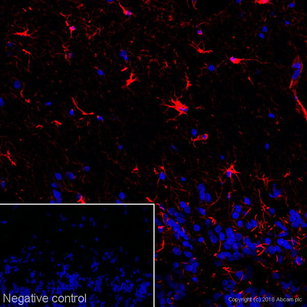 Immunohistochemistry (Frozen sections) - Alexa Fluor® 647 Anti-GFAP antibody [EPR1034Y] (AB194325), expandable thumbnail