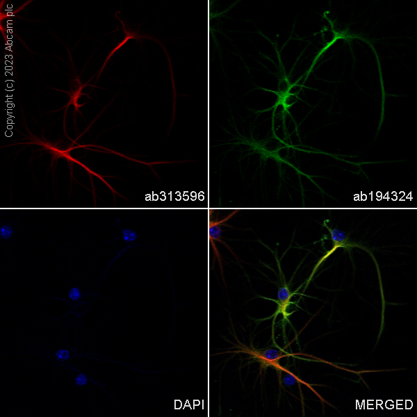 Immunocytochemistry/ Immunofluorescence - Alexa Fluor® 647 Anti-GFAP antibody [EPR1034Y] - Mouse IgG1 Chimeric (AB313596), expandable thumbnail