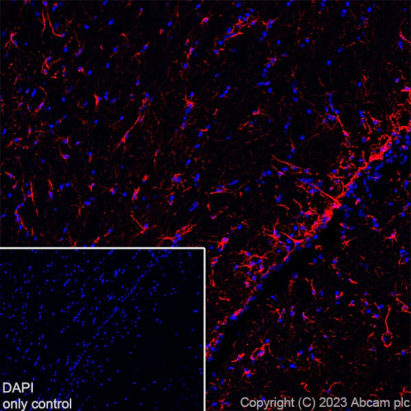 Immunohistochemistry (Frozen sections) - Alexa Fluor® 647 Anti-GFAP antibody [EPR1034Y] - Mouse IgG1 Chimeric (AB313596)