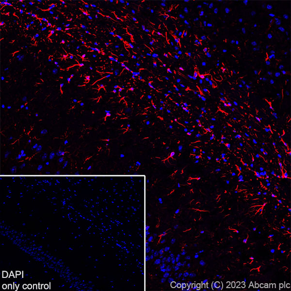 Immunohistochemistry (Frozen sections) - Alexa Fluor® 647 Anti-GFAP antibody [EPR1034Y] - Mouse IgG1 Chimeric (AB313596), expandable thumbnail