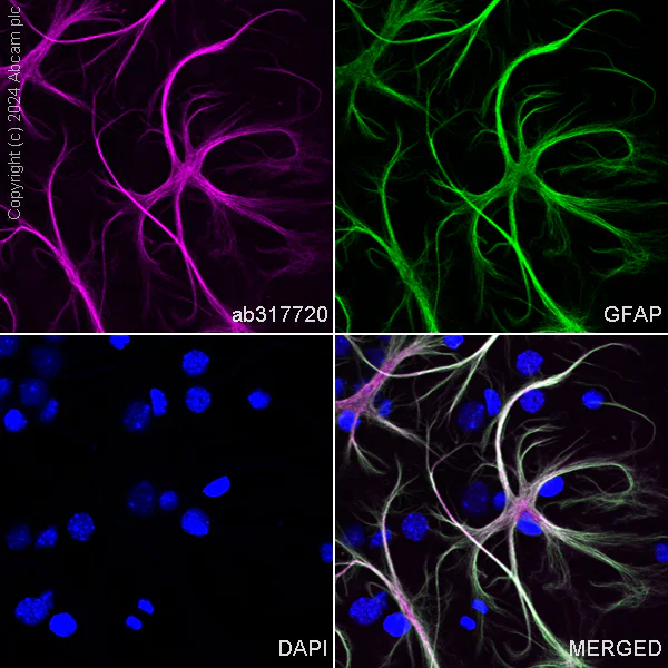 Immunocytochemistry/ Immunofluorescence - Alexa Fluor® 647 Anti-GFAP antibody [EPR1034Y] - Mouse IgG2a (Chimeric) (AB317720)