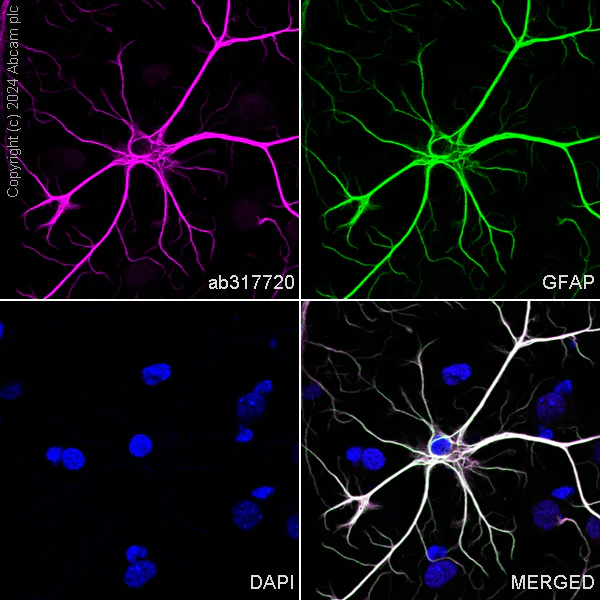 Immunocytochemistry/ Immunofluorescence - Alexa Fluor® 647 Anti-GFAP antibody [EPR1034Y] - Mouse IgG2a (Chimeric) (AB317720)