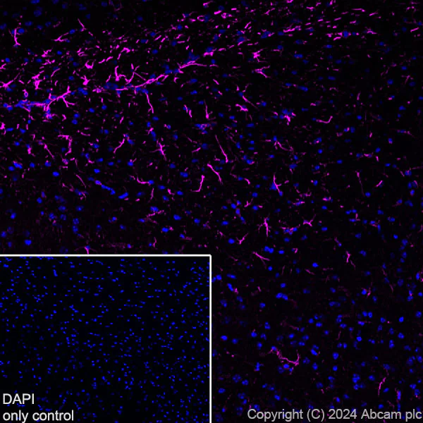Immunohistochemistry (Frozen sections) - Alexa Fluor® 647 Anti-GFAP antibody [EPR1034Y] - Mouse IgG2a (Chimeric) (AB317720)