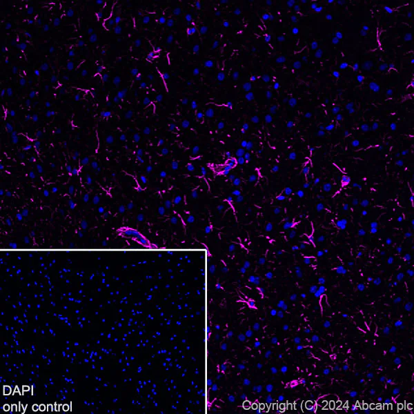 Immunohistochemistry (Frozen sections) - Alexa Fluor® 647 Anti-GFAP antibody [EPR1034Y] - Mouse IgG2a (Chimeric) (AB317720)