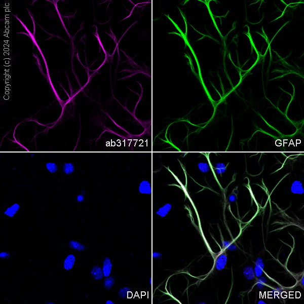 Immunocytochemistry/ Immunofluorescence - Alexa Fluor® 647 Anti-GFAP antibody [EPR1034Y] - Rat IgG2a (Chimeric) (AB317721)