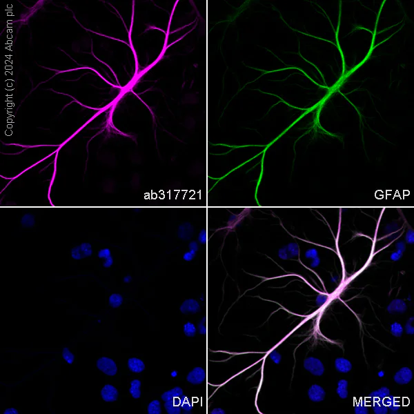 Immunocytochemistry/ Immunofluorescence - Alexa Fluor® 647 Anti-GFAP antibody [EPR1034Y] - Rat IgG2a (Chimeric) (AB317721)