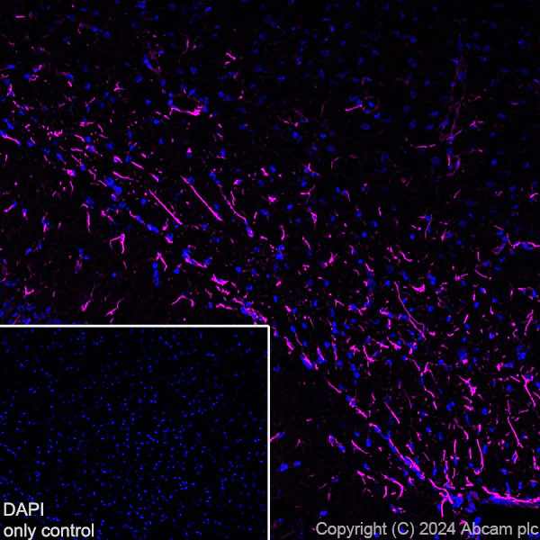 Immunohistochemistry (Frozen sections) - Alexa Fluor® 647 Anti-GFAP antibody [EPR1034Y] - Rat IgG2a (Chimeric) (AB317721)