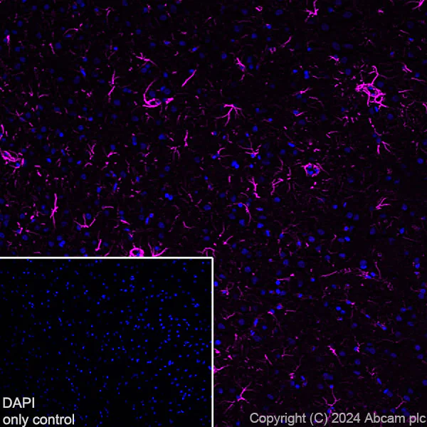 Immunohistochemistry (Frozen sections) - Alexa Fluor® 647 Anti-GFAP antibody [EPR1034Y] - Rat IgG2a (Chimeric) (AB317721)