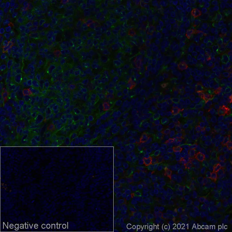 Immunohistochemistry (Formalin/PFA-fixed paraffin-embedded sections) - Alexa Fluor® 647 Anti-GITR antibody [CAL8] (AB281319)