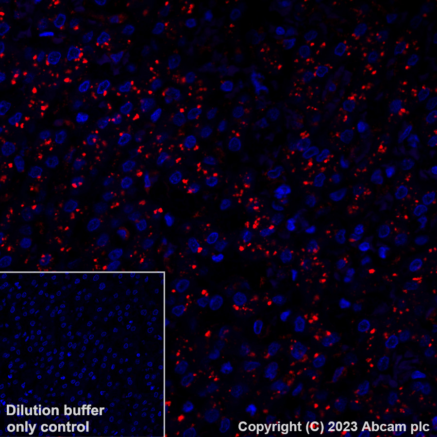Immunohistochemistry (Formalin/PFA-fixed paraffin-embedded sections) - Alexa Fluor® 647 Anti-GLB1/Beta-galactosidase antibody [EPR26120-76] (AB316341), expandable thumbnail