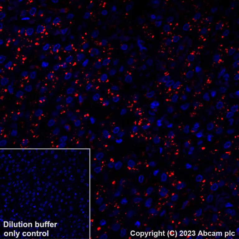 Immunohistochemistry (Formalin/PFA-fixed paraffin-embedded sections) - Alexa Fluor® 647 Anti-GLB1/Beta-galactosidase antibody [EPR26120-76] (AB316341)