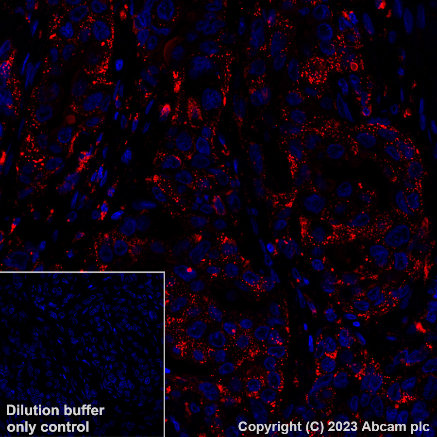 Immunohistochemistry (Formalin/PFA-fixed paraffin-embedded sections) - Alexa Fluor® 647 Anti-GLB1/Beta-galactosidase antibody [EPR26120-76] (AB316341), expandable thumbnail
