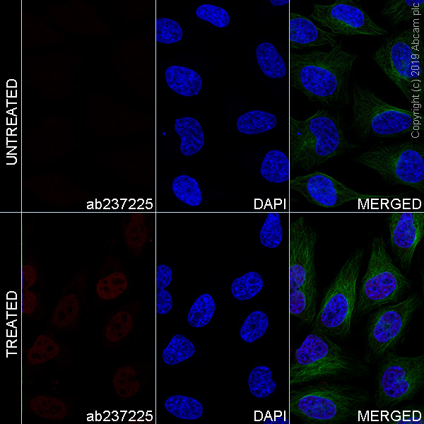 Immunocytochemistry/ Immunofluorescence - Alexa Fluor® 647 Anti-Glucocorticoid Receptor antibody [EPR19621] (AB237225), expandable thumbnail