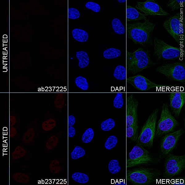 Immunocytochemistry/ Immunofluorescence - Alexa Fluor® 647 Anti-Glucocorticoid Receptor antibody [EPR19621] (AB237225)