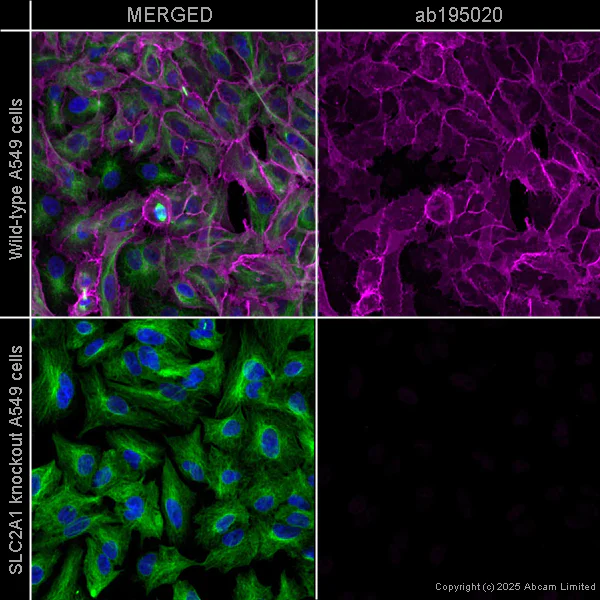 Alexa Fluor® 647 Anti-Glucose Transporter GLUT1 抗体 [EPR3915