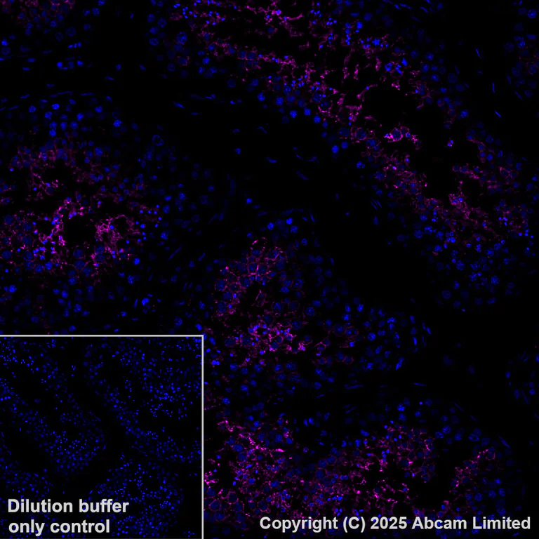 Immunohistochemistry (Formalin/PFA-fixed paraffin-embedded sections) - Alexa Fluor® 647 Anti-Glucose Transporter GLUT3 + GLUT14 antibody [EPR28481-54] (AB325112)