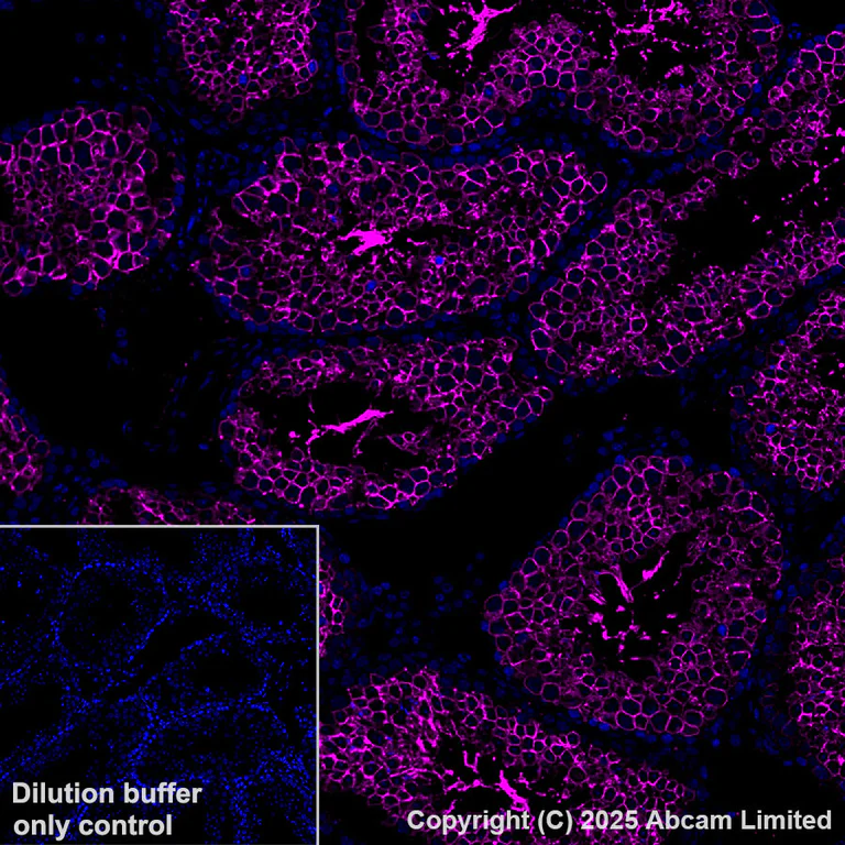 Immunohistochemistry (Formalin/PFA-fixed paraffin-embedded sections) - Alexa Fluor® 647 Anti-Glucose Transporter GLUT3 + GLUT14 antibody [EPR28481-54] (AB325112)