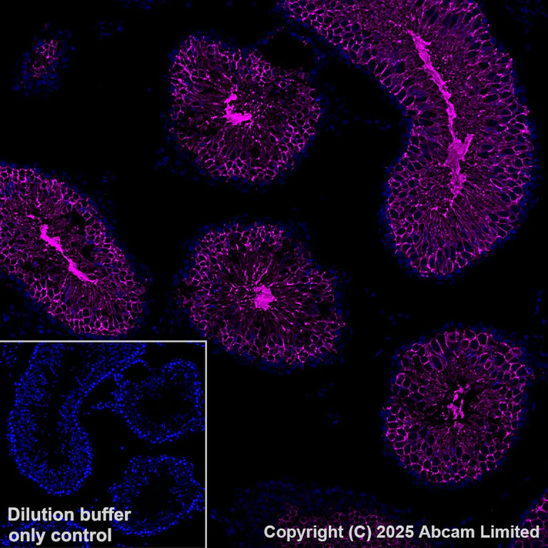 Immunohistochemistry (Formalin/PFA-fixed paraffin-embedded sections) - Alexa Fluor® 647 Anti-Glucose Transporter GLUT3 + GLUT14 antibody [EPR28481-54] (AB325112)