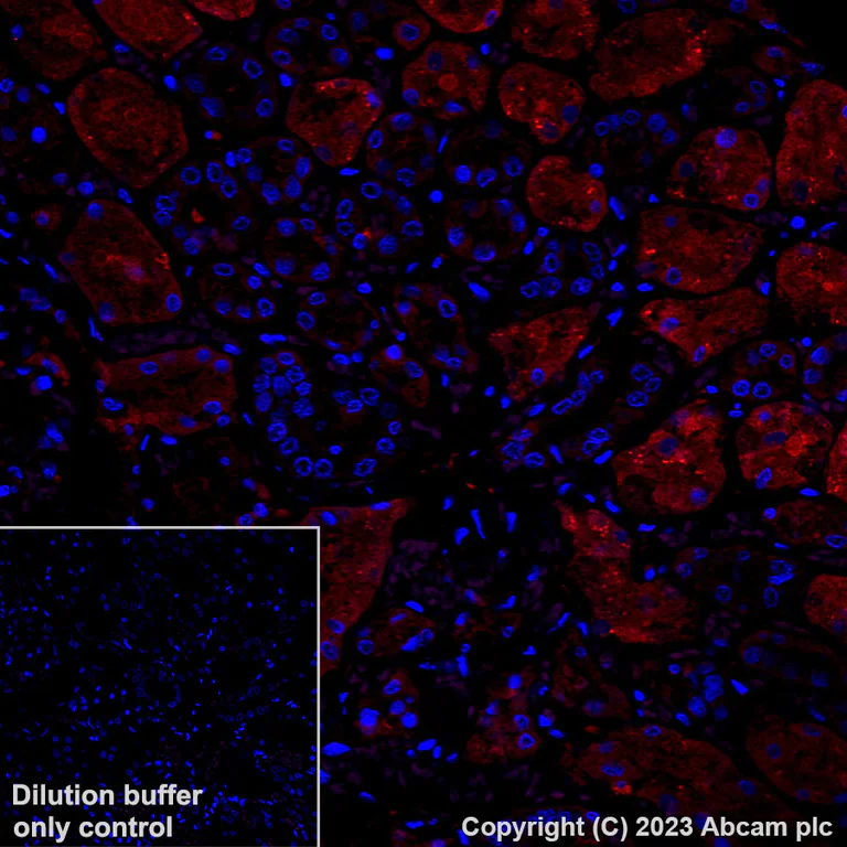 Immunohistochemistry (Formalin/PFA-fixed paraffin-embedded sections) - Alexa Fluor® 647 Anti-Glutathione Peroxidase 4 antibody [EPNCIR144] (AB314334)