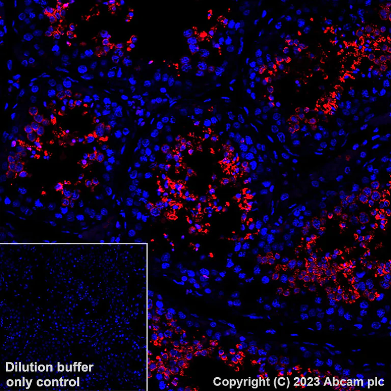 Immunohistochemistry (Formalin/PFA-fixed paraffin-embedded sections) - Alexa Fluor® 647 Anti-Glutathione Peroxidase 4 antibody [EPNCIR144] (AB314334)
