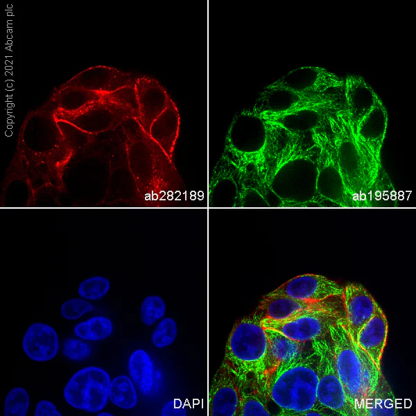 Immunocytochemistry/ Immunofluorescence - Alexa Fluor® 647 Anti-Glypican 3 antibody [SP86] (AB282189)