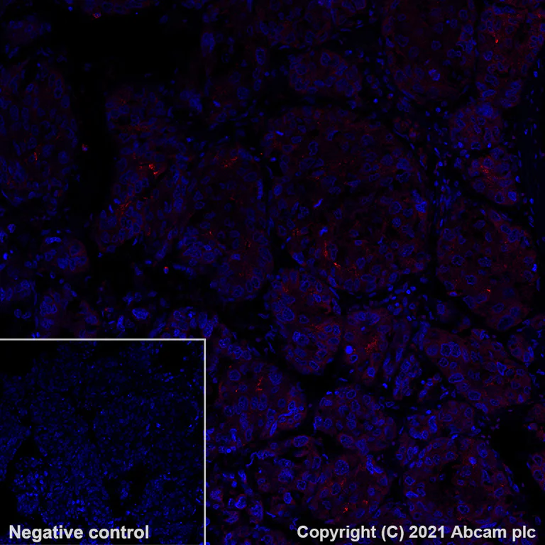 Immunohistochemistry (Formalin/PFA-fixed paraffin-embedded sections) - Alexa Fluor® 647 Anti-Glypican 3 antibody [SP86] (AB282189)