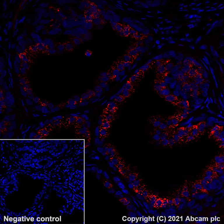 Immunohistochemistry (Formalin/PFA-fixed paraffin-embedded sections) - Alexa Fluor® 647 Anti-Glypican 3 antibody [SP86] (AB282189)
