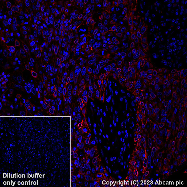 Immunohistochemistry (Formalin/PFA-fixed paraffin-embedded sections) - Alexa Fluor® 647 Anti-GM130 antibody [EP892Y] - cis-Golgi Marker (AB195303)