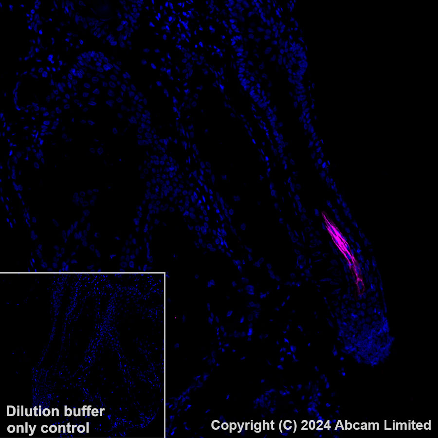 Immunohistochemistry (Formalin/PFA-fixed paraffin-embedded sections) - Alexa Fluor® 647 Anti-GPCR GPRC5D antibody [EPR28376-41] (AB323465), expandable thumbnail