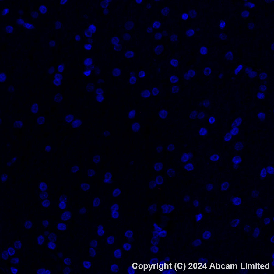 Immunohistochemistry (Formalin/PFA-fixed paraffin-embedded sections) - Alexa Fluor® 647 Anti-GPCR GPRC5D antibody [EPR28376-41] (AB323465), expandable thumbnail