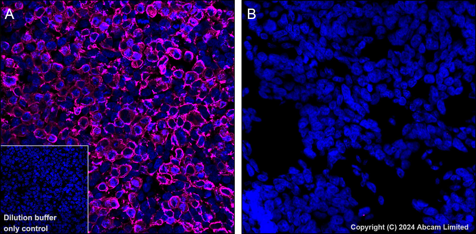 Immunohistochemistry (Formalin/PFA-fixed paraffin-embedded sections) - Alexa Fluor® 647 Anti-GPCR GPRC5D antibody [EPR28376-41] (AB323465), expandable thumbnail