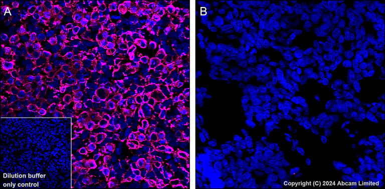 Immunohistochemistry (Formalin/PFA-fixed paraffin-embedded sections) - Alexa Fluor® 647 Anti-GPCR GPRC5D antibody [EPR28376-41] (AB323465)