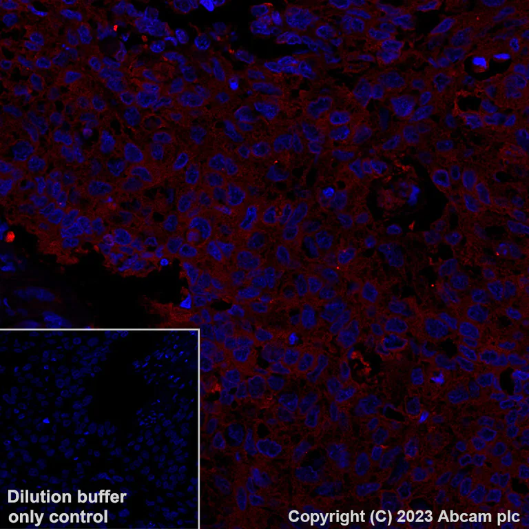 Immunohistochemistry (Formalin/PFA-fixed paraffin-embedded sections) - Alexa Fluor® 647 Anti-GPCR LGR6 antibody [EPR6874] (AB315362)