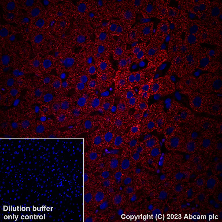 Immunohistochemistry (Formalin/PFA-fixed paraffin-embedded sections) - Alexa Fluor® 647 Anti-GPCR LGR6 antibody [EPR6874] (AB315362)